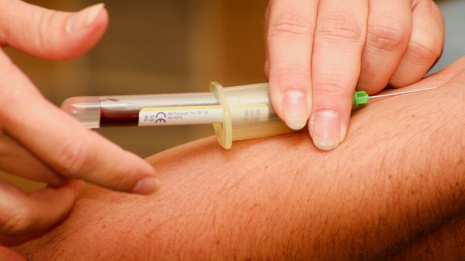 Cientistas brasileiros avançam em diagnóstico de Alzheimer a partir de exames de sangue
