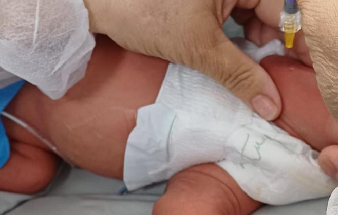 Hospitais estaduais oferecem proteção contra bronquiolite a bebês prematuros