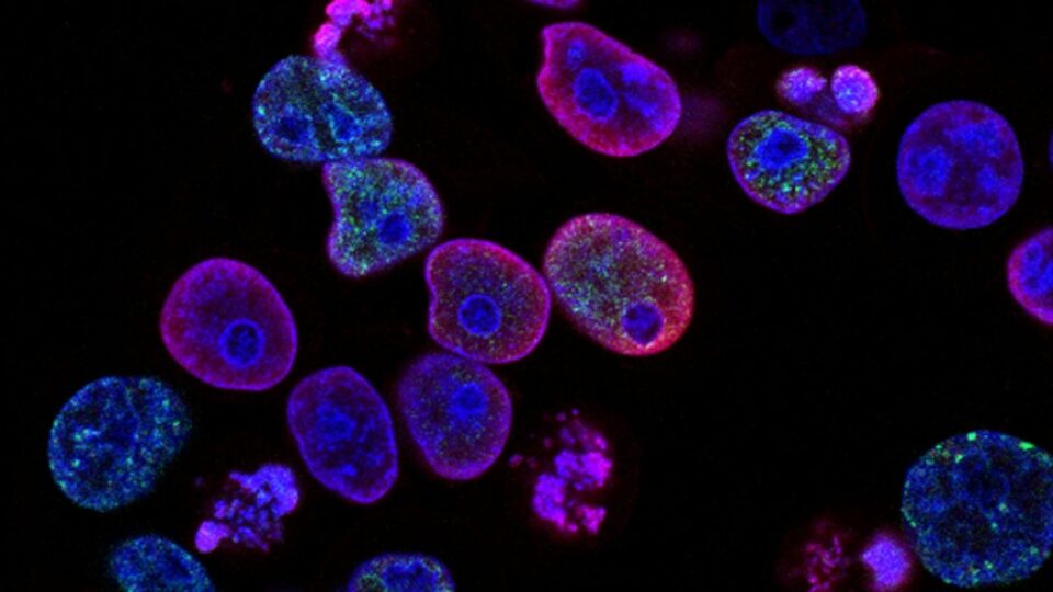 Terapia para rejuvenescer células é testada em humanos pela primeira vez